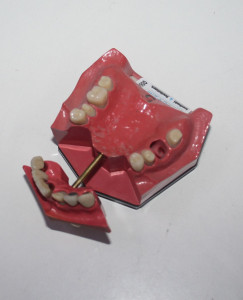 Preview: Go Dent Schaumodell Nr. 5  # 00647